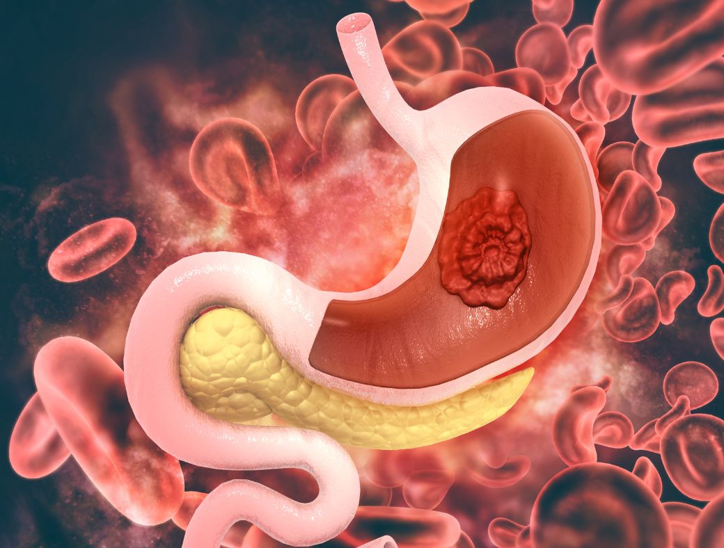 chi nei tsang,massage chi nei tsang,chi nei tsang paris,chi nei tsang paris 13,chi nei tsang paris 10,chi nei tsang paris centre,chi nei tsang ile de france,lien corps esprit,chi nei tsang massage du ventre,chi nei tsang massage,massage abdominal,massage abdominal paris,chi nei tsang paris,chi nei tsang tarif,chi nei tsang definition