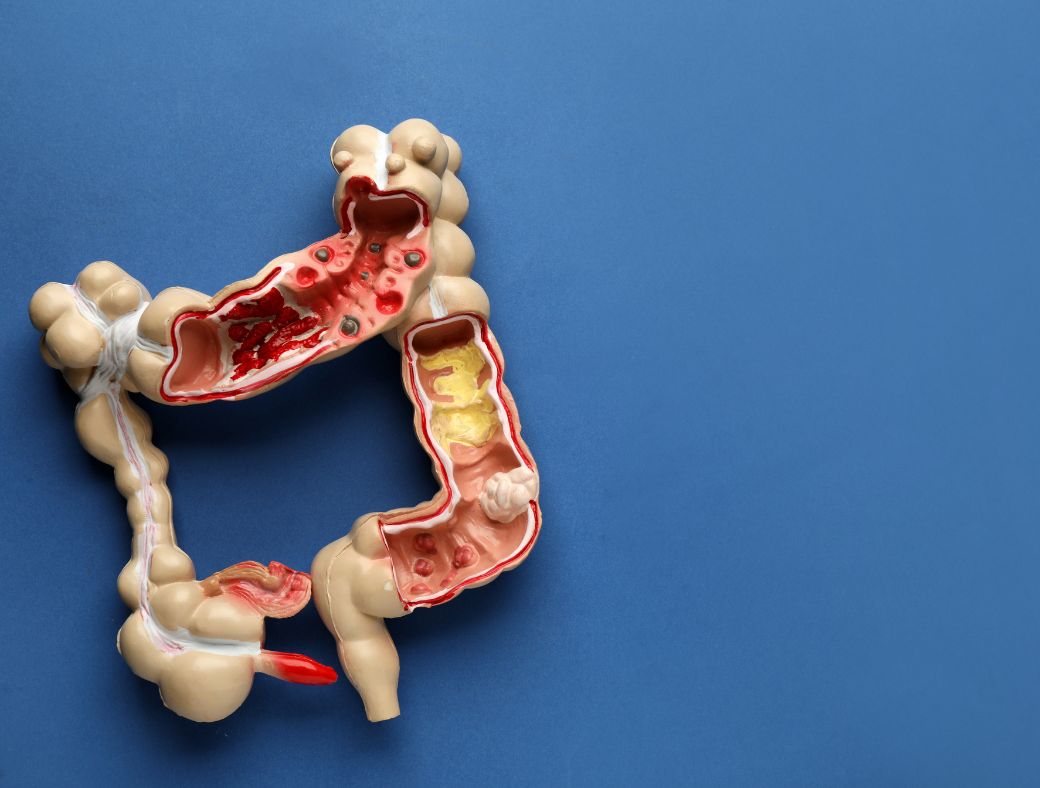 Modèle anatomique détaillé du tractus gastro-intestinal humain ouvert sur fond bleu.